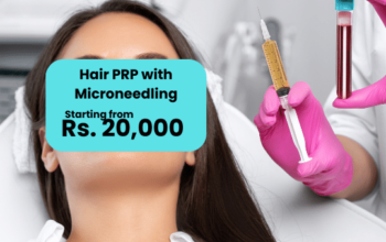 Hair PRP with Microneedling Treatment Islamabad