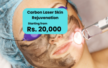Carbon Laser Skin Rejuvenation Cost in Islamabad
