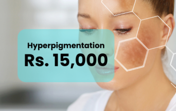 Hyperpigmentation Treatment Islamabad Rawalpindi
