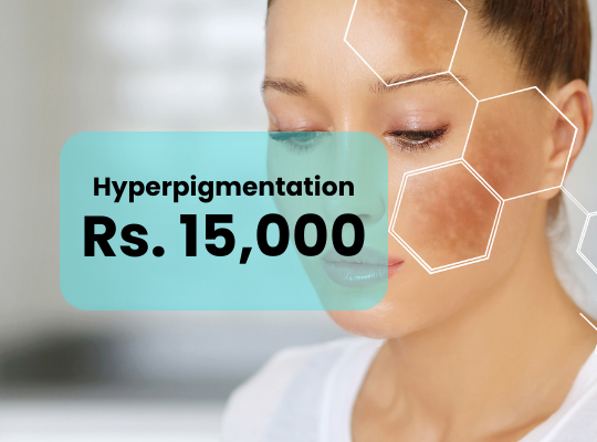 Hyperpigmentation Treatment Islamabad Rawalpindi