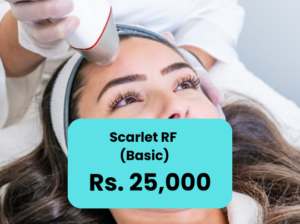 Scarlet RF Microneedling Treatment in Islamabad