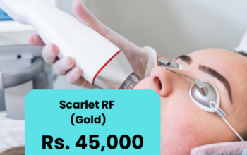 Scarlet Laser Treatment for Face Price Islamabad