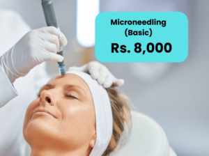Microneedling for Acne Scars in Islamabad Lahore