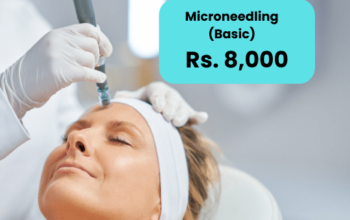 Microneedling for Acne Scars in Islamabad Lahore