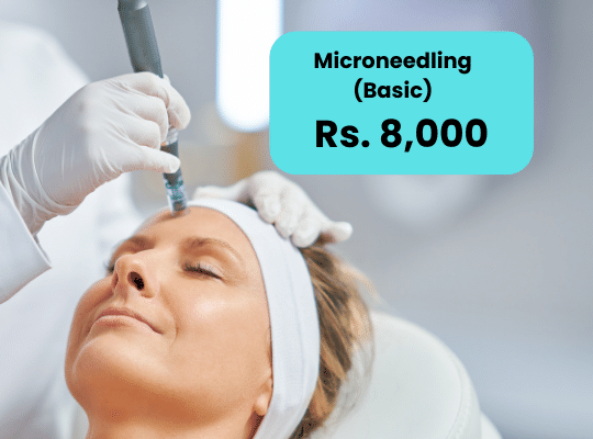 Microneedling for Acne Scars in Islamabad Lahore