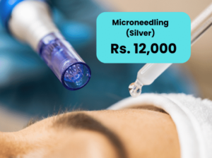 Microneedling Treatment for Pigmentation Islamabad