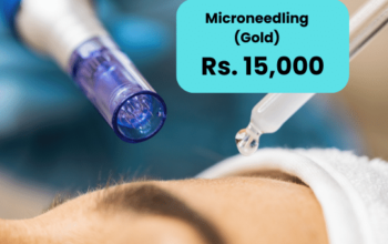 Microneedling for Melasma in Islamabad Lahore