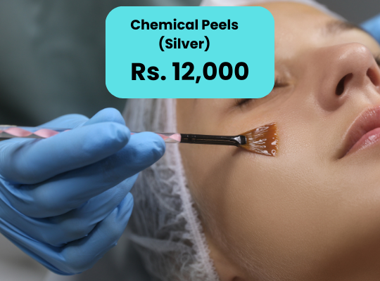 Chemical Peel for Skin Glow Price in Islamabad