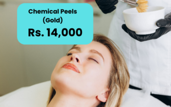 Chemical Peel for Acne Scars Price in Islamabad