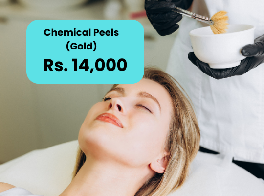 Chemical Peel for Acne Scars Price in Islamabad