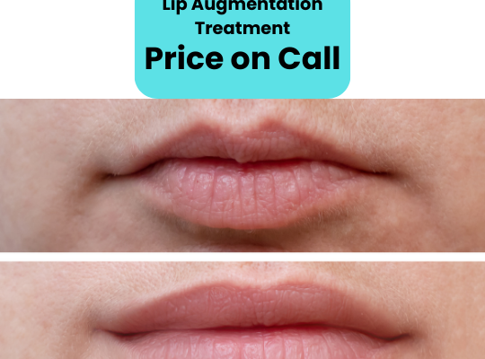 Lip Augmentation Treatment Price Islamabad Lahore