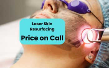 Laser Skin Resurfacing Treatment Islamabad Lahore